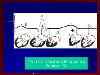 AUSCUSTA CARDÍACA
Componentes e característica das bulhas

• B1 = M1T1

• B2 = A2 P2

• Bulhas Normofonéticas
          Fim da Sístole fecha-se a válvula Aórtica e
          HipofonéticasPulmonar =B2
          Hiperfonéticas
 