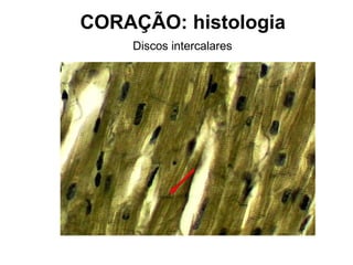 Discos intercalares
CORAÇÃO: histologia
 