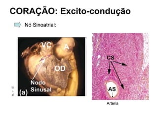 CORAÇÃO: Excito-condução
Nó Sinoatrial:
Arteria
 