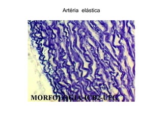 Artéria elástica
 