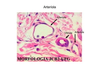 Arteríola
Vênula Arteríola
Arteríola
 