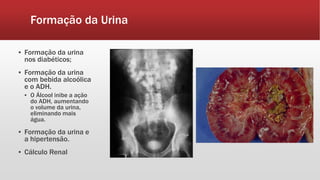 Formação da Urina
▪ Formação da urina
nos diabéticos;
▪ Formação da urina
com bebida alcoólica
e o ADH.
▪ O Álcool inibe a ação
do ADH, aumentando
o volume da urina,
eliminando mais
água.
▪ Formação da urina e
a hipertensão.
▪ Cálculo Renal
 