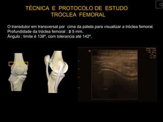 TÉCNICA E PROTOCOLO DE ESTUDO
                 TRÓCLEA FEMORAL

O transdutor em transversal por cima da patela para visualizar a tróclea femoral.
Profundidade da tróclea femoral : ≥ 5 mm.
Ángulo : limite é 138º, com tolerancia até 142º.
 