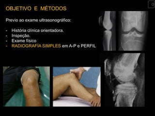 OBJETIVO E MÉTODOS

Previo ao exame ultrasonográfico:

-   História clínica orientadora.
-   Inspeção.
-   Exame físico
-   RADIOGRAFÍA SIMPLES em A-P e PERFIL.
 