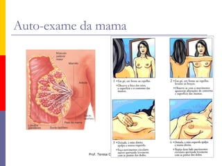 Auto-exame da mama 