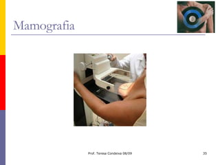 Mamografia 