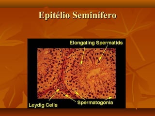 Epitélio SeminíferoEpitélio Seminífero
 