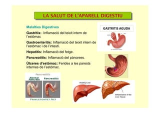 LA SALUT DE L’APARELL DIGESTIULA SALUT DE L’APARELL DIGESTIU
Malalties Digestives
Gastritis:. Inflamació del teixit intern de
l’estòmac
Gastroenteritis: Inflamació del teixit intern de
l’estòmac i de l’intestí.
Hepatitis: Inflamació del fetge.
Pancreatitis: Inflamació del pàncrees.
Úlceres d’estòmac: Ferides a les parests
internes de l’estòmac.
 
