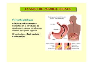 LA SALUT DE L’APARELL DIGESTIULA SALUT DE L’APARELL DIGESTIU
Proves Diagnòstiques
• Exploració Endoscòpica:
Consisteix en la introducció de
sondes amb càmera per observar
l’interior de l’aparell digestiu.
Hi ha dos tipus: Gastroscòpia i
Colonoscòpia.
 