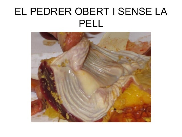 Resultat d'imatges de pedrer gallina