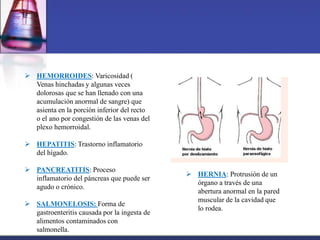  HEMORROIDES: Varicosidad (
Venas hinchadas y algunas veces
dolorosas que se han llenado con una
acumulación anormal de sangre) que
asienta en la porción inferior del recto
o el ano por congestión de las venas del
plexo hemorroidal.
 HEPATITIS: Trastorno inflamatorio
del hígado.
 PANCREATITIS: Proceso
inflamatorio del páncreas que puede ser
agudo o crónico.
 SALMONELOSIS: Forma de
gastroenteritis causada por la ingesta de
alimentos contaminados con
salmonella.
 HERNIA: Protrusión de un
órgano a través de una
abertura anormal en la pared
muscular de la cavidad que
lo rodea.
 