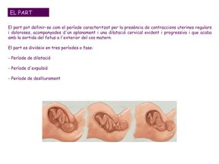 EL PART El part pot definir-se com el període caracteritzat per la presència de contraccions uterines regulars i doloroses, acompanyades d'un aplanament i una dilatació cervical evident i progressiva i que acaba amb la sortida del fetus a l'exterior del cos matern.  El part es divideix en tres períodes o fase:  - Període de dilatació  - Període d'expulsió - Període de deslliurament  
