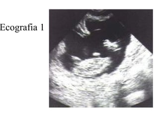 Ecografia 1 