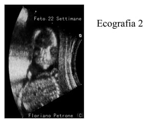 Ecografia 2 