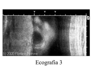 Ecografia 3 