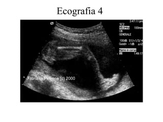 Ecografia 4 