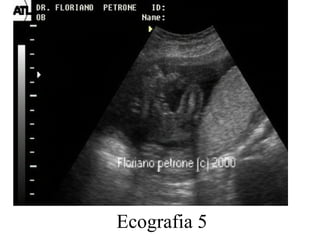 Ecografia 5 
