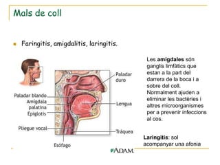 Mals de coll


   Faringitis, amigdalitis, laringitis.

                                            Les amígdales són
                                            ganglis limfàtics que
                                            estan a la part del
                                            darrera de la boca i a
                                            sobre del coll.
                                            Normalment ajuden a
                                            eliminar les bactèries i
                                            altres microorganismes
                                            per a prevenir infeccions
                                            al cos.


                                           Laringitis: sol
                                           acompanyar una afonia
 