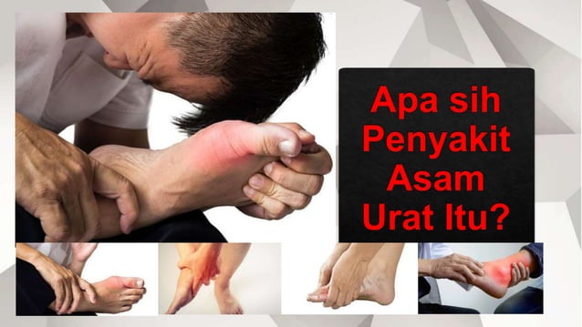 Apa sih penyakit asam urat itu | PPTX