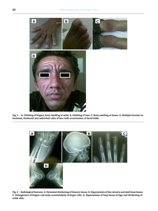 A patient with joint pains, skin changes and clubbing | PDF