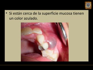 • Si están cerca de la superficie mucosa tienen
  un color azulado.
 