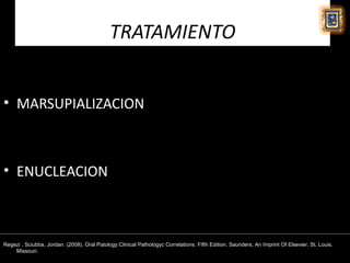 TRATAMIENTO


• MARSUPIALIZACION



• ENUCLEACION



Regezi , Sciubba, Jordan. (2008). Oral Patology:Clinical Pathologyc Correlations. Fifth Edition. Saunders, An Imprint Of Elsevier. St. Louis.
    Missouri.
 