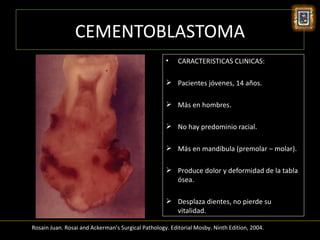 CEMENTOBLASTOMA
                                                    •    CARACTERISTICAS CLINICAS:

                                                     Pacientes jóvenes, 14 años.

                                                     Más en hombres.

                                                     No hay predominio racial.

                                                     Más en mandíbula (premolar – molar).

                                                     Produce dolor y deformidad de la tabla
                                                      ósea.

                                                     Desplaza dientes, no pierde su
                                                      vitalidad.

Rosain Juan. Rosai and Ackerman’s Surgical Pathology. Editorial Mosby. Ninth Edition, 2004.
 