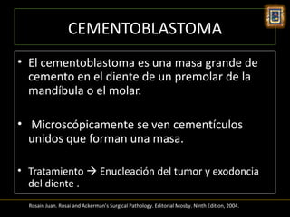 CEMENTOBLASTOMA
• El cementoblastoma es una masa grande de
  cemento en el diente de un premolar de la
  mandíbula o el molar.

• Microscópicamente se ven cementículos
  unidos que forman una masa.

• Tratamiento  Enucleación del tumor y exodoncia
  del diente .
  Rosain Juan. Rosai and Ackerman’s Surgical Pathology. Editorial Mosby. Ninth Edition, 2004.
 
