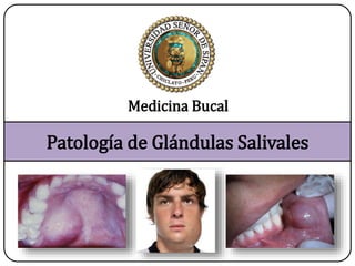 Patología de Glándulas Salivales
Medicina Bucal
 