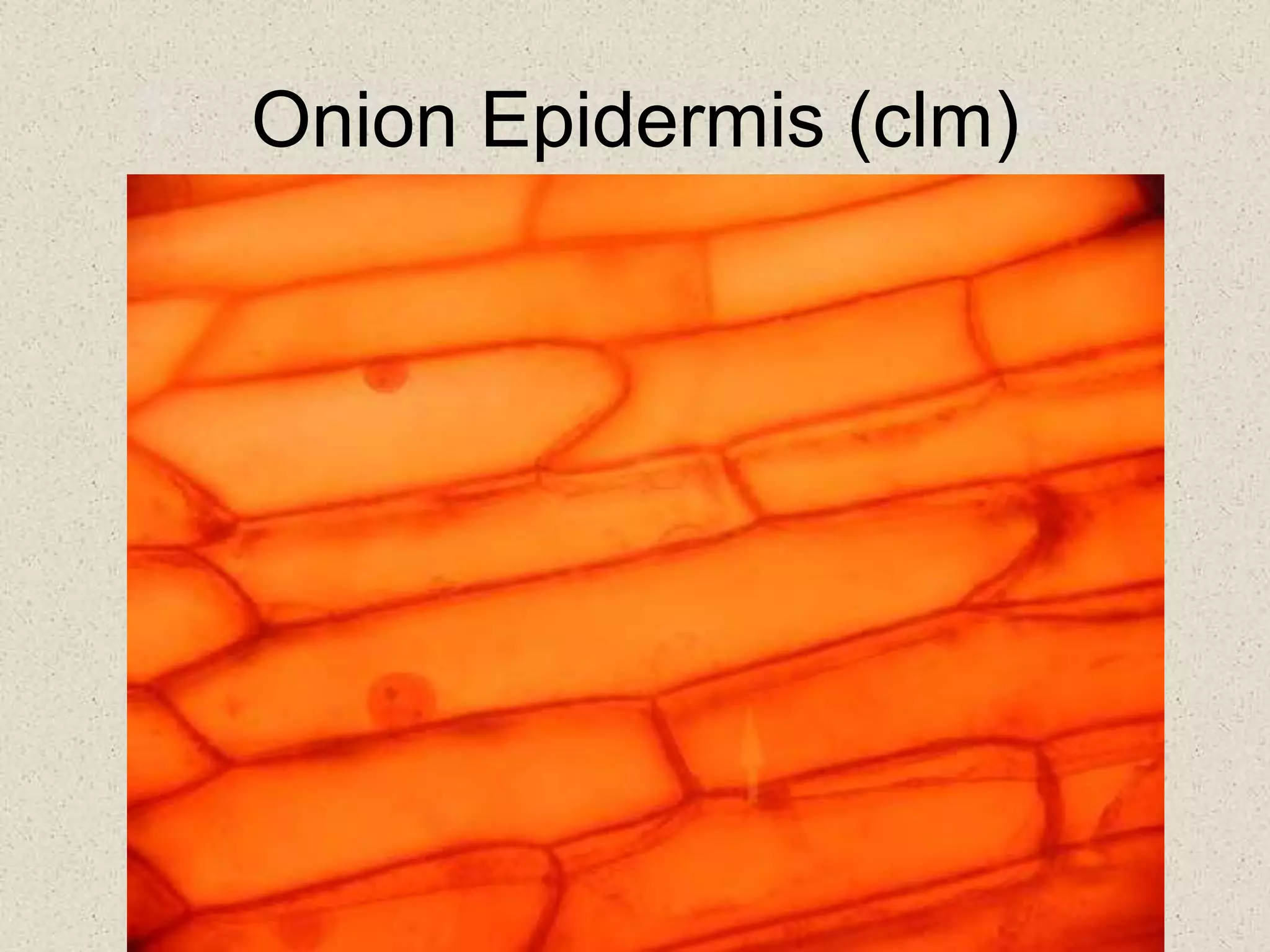 Onion Epidermis (clm)
 