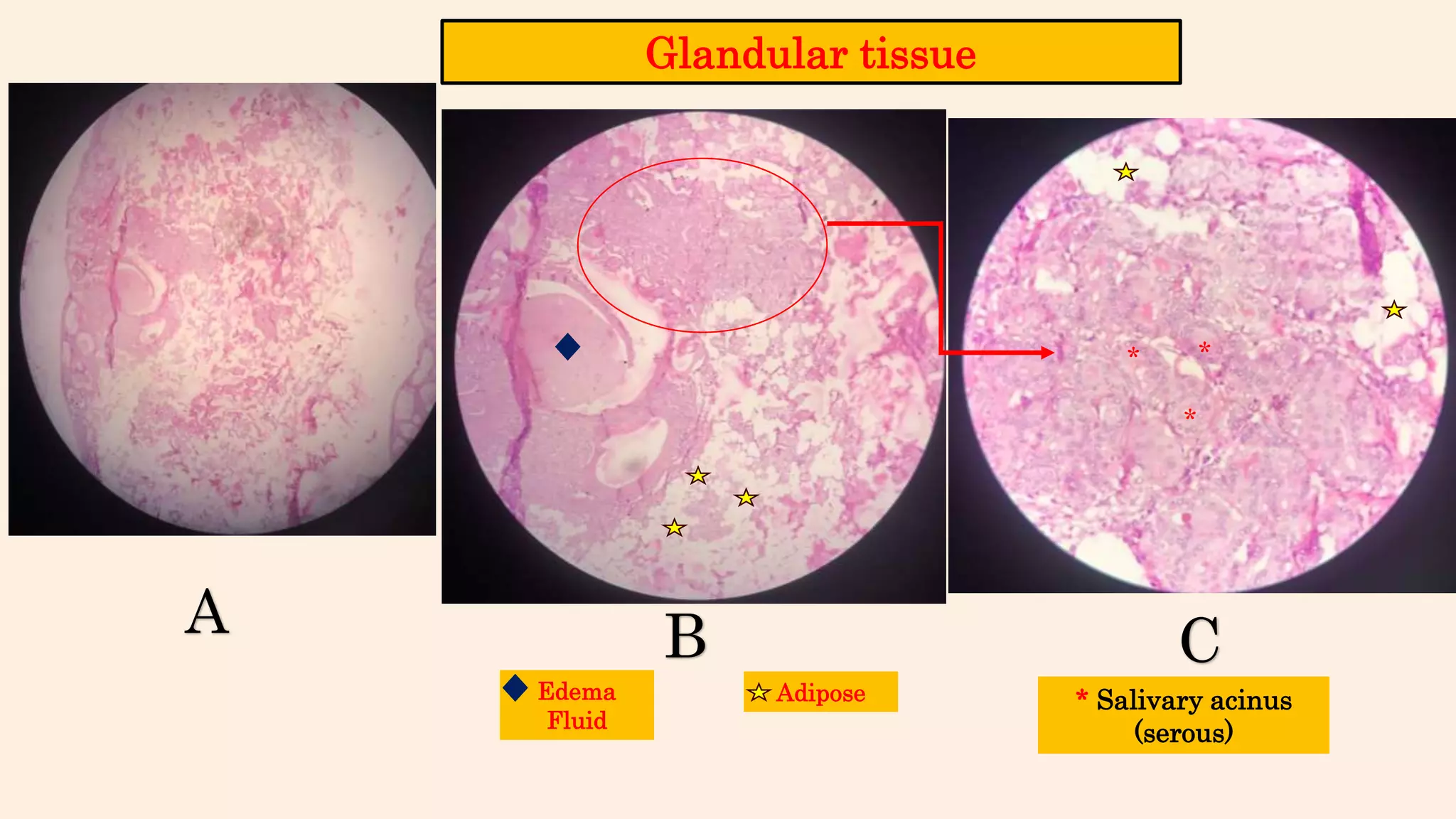 Anatomic Pathology Case Report | PPTX