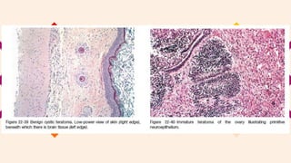 Anatomic Pathology Case Report | PPTX