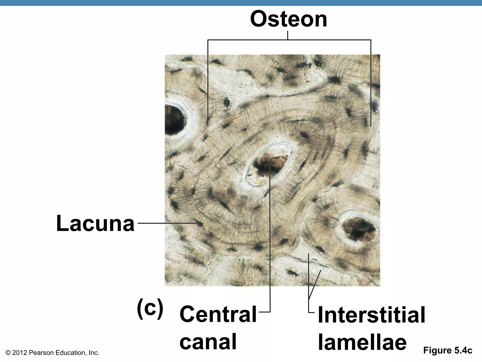 Osteon




               Lacuna


                                 (c) Central    Interstitial
© 2012 Pearson Education, Inc.
                                     canal      lamellae Figure 5.4c
 