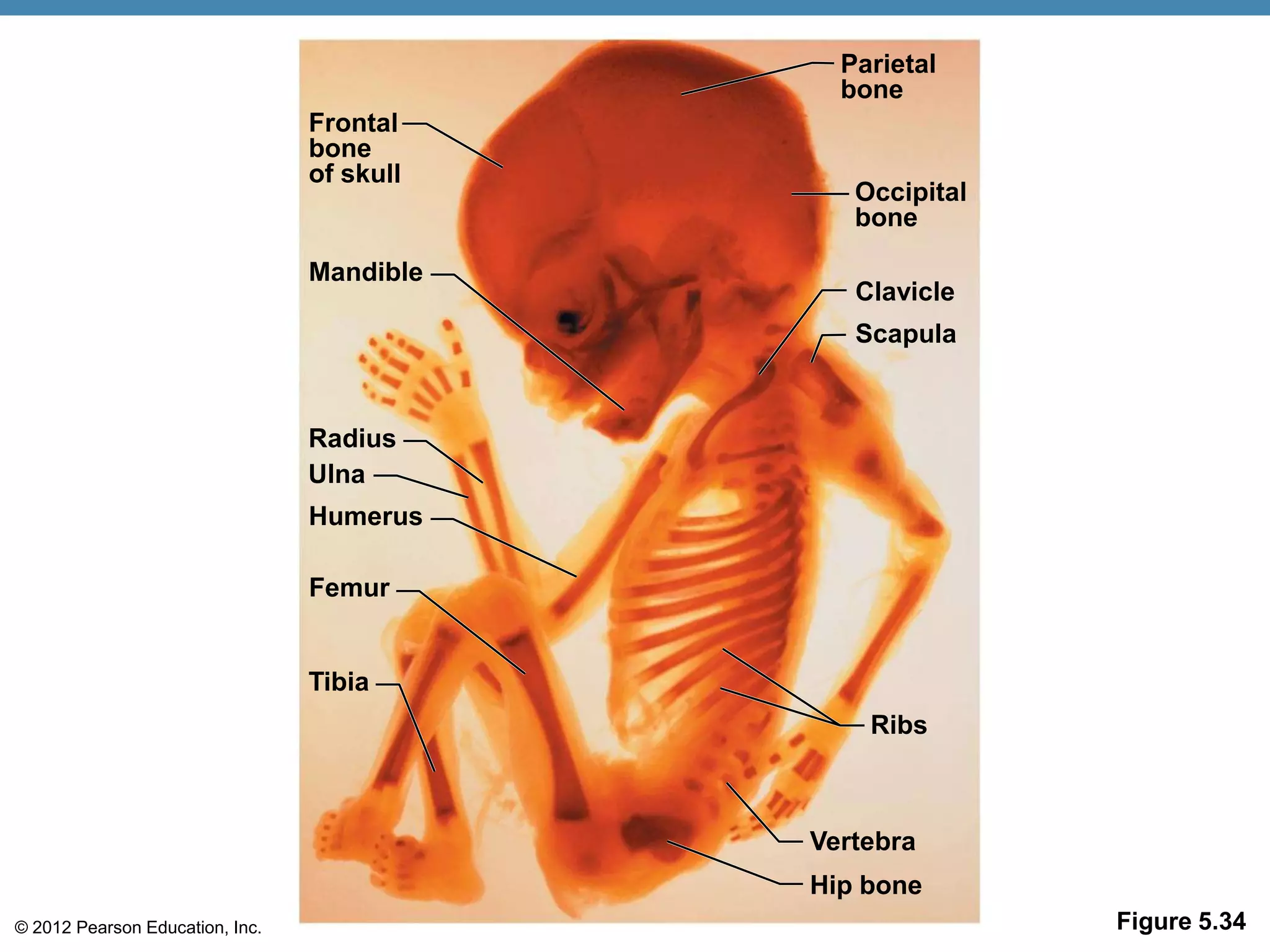 Parietal
                                              bone
                                 Frontal
                                 bone
                                 of skull
                                               Occipital
                                               bone

                                 Mandible
                                               Clavicle
                                               Scapula


                                 Radius
                                 Ulna
                                 Humerus

                                 Femur


                                 Tibia
                                                Ribs



                                            Vertebra
                                            Hip bone
© 2012 Pearson Education, Inc.                             Figure 5.34
 