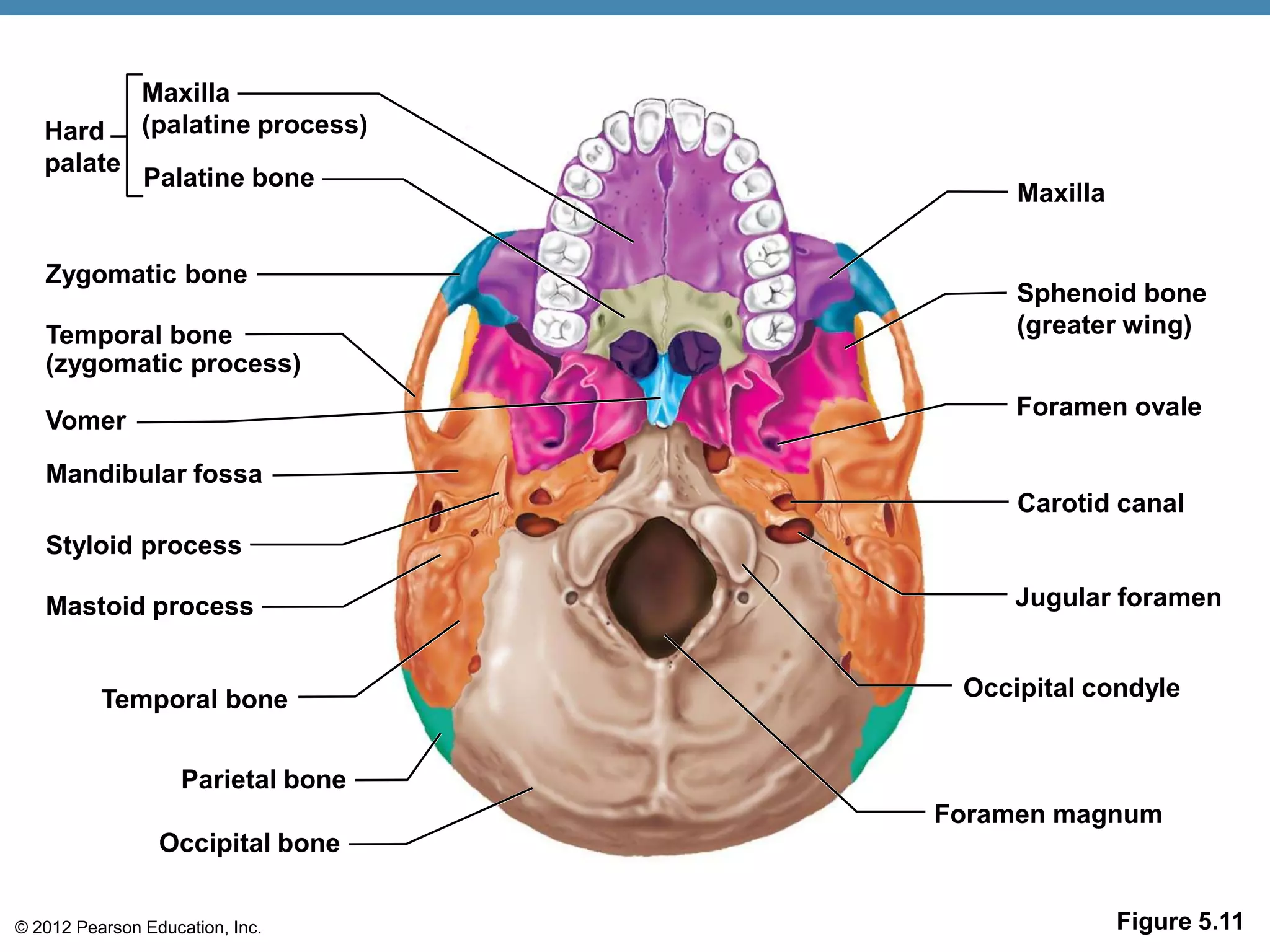 Maxilla
   Hard        (palatine process)
   palate
               Palatine bone
                                         Maxilla


   Zygomatic bone
                                         Sphenoid bone
   Temporal bone                         (greater wing)
   (zygomatic process)
                                         Foramen ovale
   Vomer

   Mandibular fossa
                                         Carotid canal
   Styloid process

   Mastoid process                       Jugular foramen


          Temporal bone              Occipital condyle


                    Parietal bone
                                    Foramen magnum
                 Occipital bone


© 2012 Pearson Education, Inc.                     Figure 5.11
 