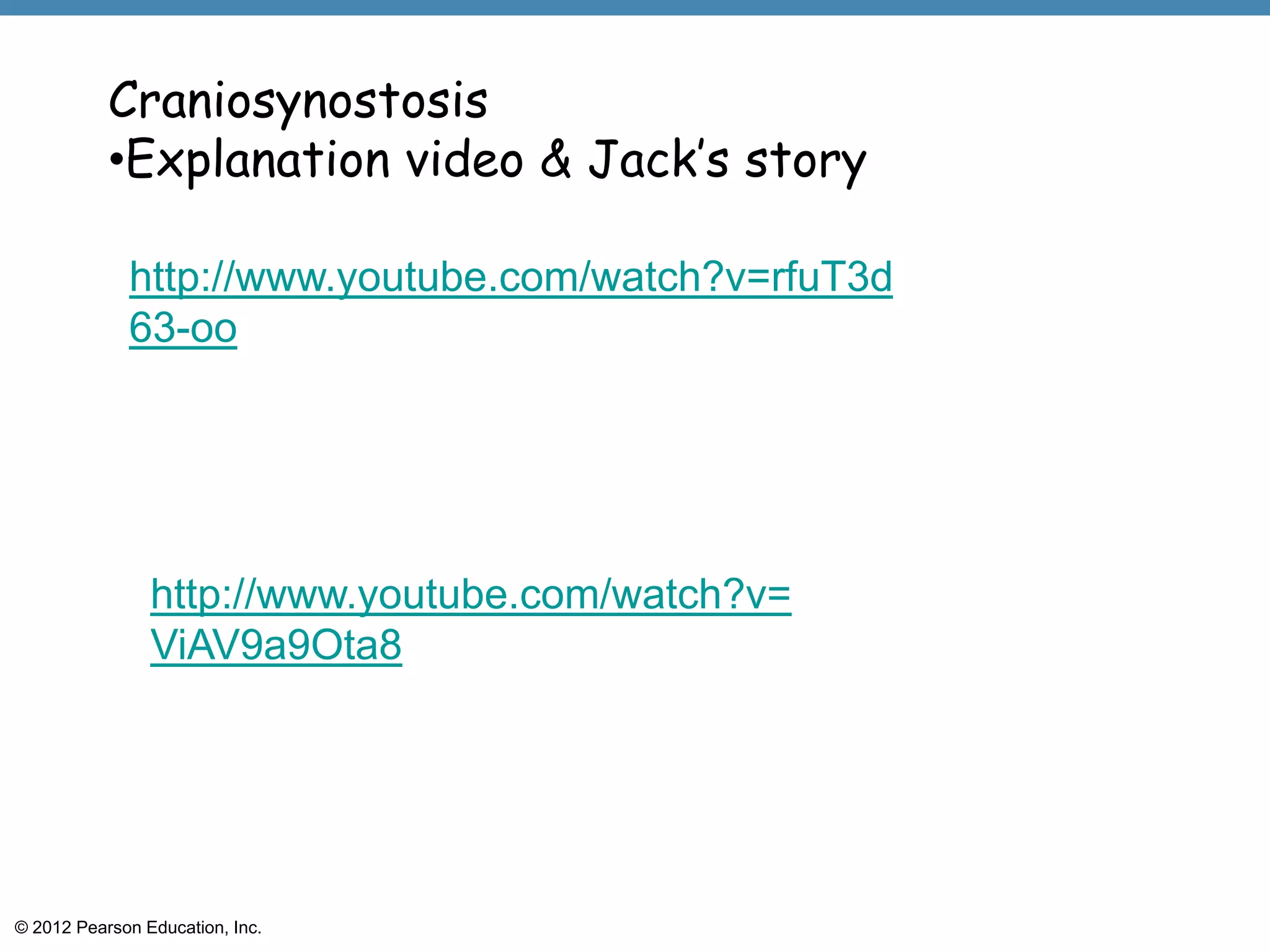 Craniosynostosis
           •Explanation video & Jack’s story

             http://www.youtube.com/watch?v=rfuT3d
             63-oo




                http://www.youtube.com/watch?v=
                ViAV9a9Ota8




© 2012 Pearson Education, Inc.
 