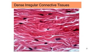 21
Dense Irregular Connective Tissues
 