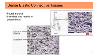 22
Dense Elastic Connective Tissues
• Found in aorta
• Stretches and recoils to
propel blood.
 
