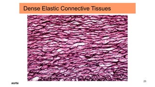 23
Dense Elastic Connective Tissues
aorta
 