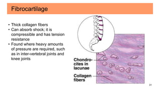 31
Fibrocartilage
• Thick collagen fibers
• Can absorb shock; it is
compressible and has tension
resistance
• Found where heavy amounts
of pressure are required, such
as in inter-vertebral joints and
knee joints
 
