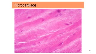 32
Fibrocartilage
 
