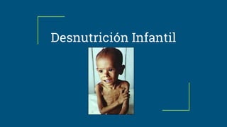 Desnutrición Infantil
 