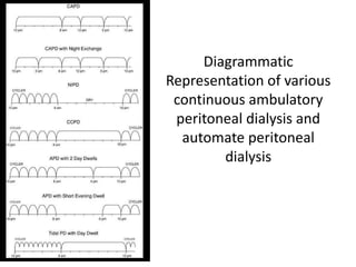 Diagrammatic
Representation of various
 continuous ambulatory
 peritoneal dialysis and
  automate peritoneal
        dialysis
 