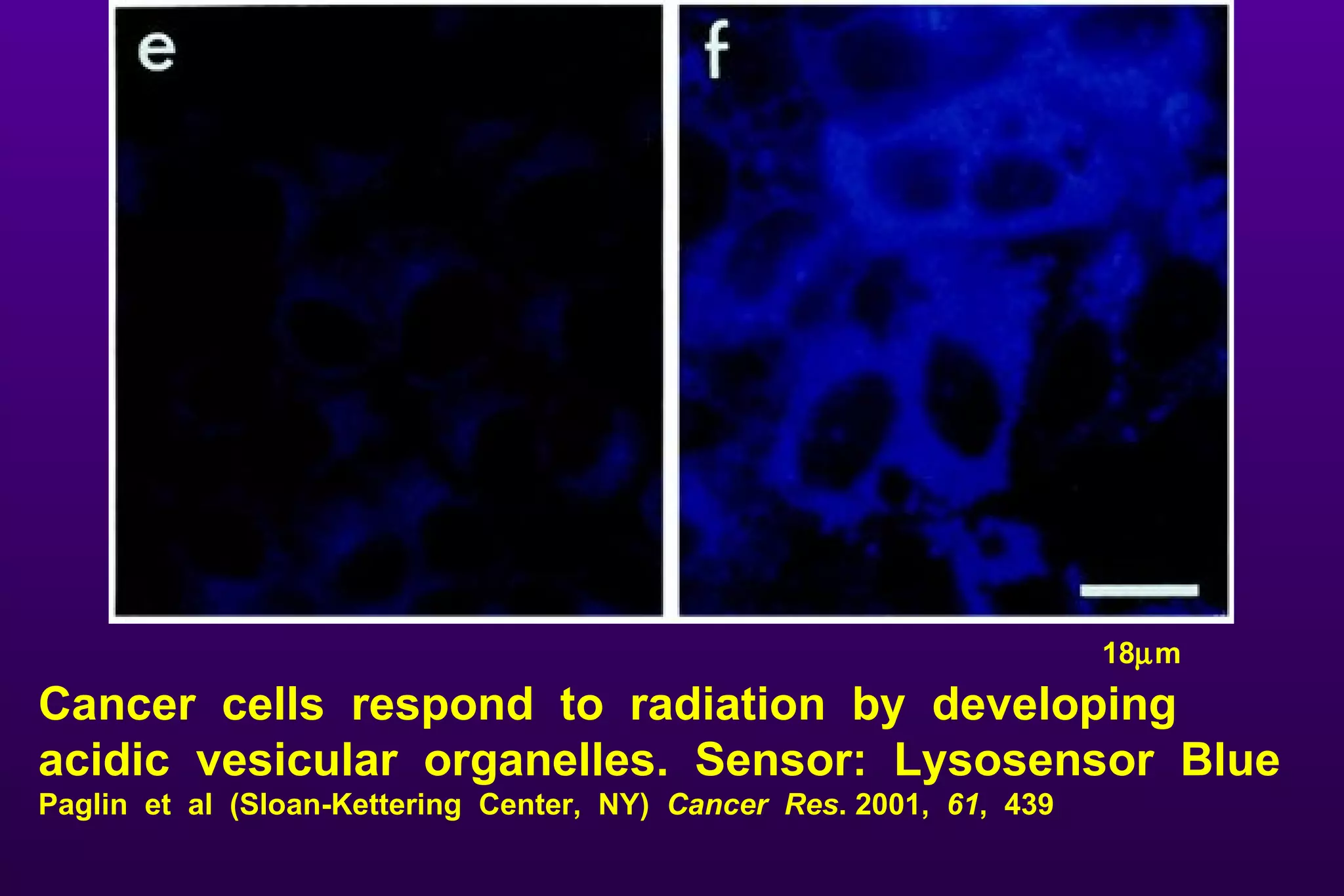 Cancer  cells  respond  to  radiation  by  developing  acidic  vesicular  organelles.  Sensor:  Lysosensor  Blue  Paglin  et  al  (Sloan-Kettering  Center,  NY)  Cancer  Res . 2001,  61 ,  439 18  m 