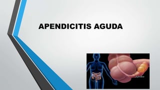 APENDICITIS AGUDA
 