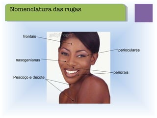Pescoço e decote periorais perioculares nasogenianas frontais Nomenclatura das rugas 
