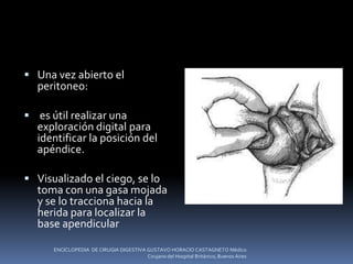  Una vez abierto el
peritoneo:
 es útil realizar una
exploración digital para
identificar la posición del
apéndice.
 Visualizado el ciego, se lo
toma con una gasa mojada
y se lo tracciona hacia la
herida para localizar la
base apendicular
ENCICLOPEDIA DE CIRUGIA DIGESTIVA GUSTAVO HORACIO CASTAGNETO Médico
Cirujano del Hospital Británico, Buenos Aires
 