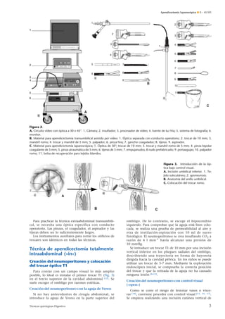 Apendicectomía laparoscópica ¶ E – 40-505

1

2

2

3

3

1

4
5

4

6
5

7

6

8

7
8
9

9

B

10
11

C

Figura 2.
A. Circuito vídeo con óptica a 30 o 45°. 1. Cámara; 2. insuﬂador; 3. procesador de vídeo; 4. fuente de luz fría; 5. sistema de fotografía; 6.
monitor.
B. Material para apendicectomía transumbilical asistida por vídeo: 1. Óptica separada con conducto operatorio; 2. trocar de 10 mm; 3.
mandril romo; 4. trocar y mandril de 5 mm; 5. palpador; 6. pinza ﬁna; 7. gancho coagulador; 8. tijeras. 9. aspirador.
C. Material para apendicectomía laparoscópica; 1. Óptica de 30°; trocar de 10 mm; 3. trocar y mandril romo de 5 mm; 4. pinza bipolar
coagulante de 5 mm; 5. pinza atraumática de 5 mm; 6. tijeras de 5 mm; 7. empujanudos; 8 nudo prefabricado; 9. portaagujas; 10. palpador
romo; 11. bolsa de recuperación para tejidos blandos.

Figura 3. Introducción de la óptica bajo control visual.
A. Incisión umbilical inferior. 1. Tejido subcutáneo; 2. aponeurosis.
B. Anatomía del anillo umbilical.
C. Colocación del trocar romo.

1
2

A

Para practicar la técnica extraabdominal transumbilical, se necesita una óptica específica con conducto
operatorio. Las pinzas, el coagulador, el aspirador y las
tijeras deben ser lo suficientemente largos.
Los instrumentos auxiliares para cerrar los orificios de
trocares son idénticos en todas las técnicas.

Técnica de apendicectomía totalmente
intraabdominal («in»)
Creación del neumoperitoneo y colocación
del trocar óptico T1
Para contar con un campo visual lo más amplio
posible, lo ideal es instalar el primer trocar T1 (Fig. 3)
en el tercio superior de la cavidad abdominal [12]. Se
suele escoger el ombligo por razones estéticas.
Creación del neumoperitoneo con la aguja de Veress
Si no hay antecedentes de cirugía abdominal, se
introduce la aguja de Veress en la parte superior del
Técnicas quirúrgicas Digestivo

ombligo. De lo contrario, se escoge el hipocondrio
izquierdo. Para comprobar que la aguja está bien colocada, se realiza una prueba de permeabilidad al aire y
otra de instilación-aspiración con 10 ml de suero
fisiológico. El neumoperitoneo se crea insuflando CO2 a
razón de 4 l min -1 hasta alcanzar una presión de
10 mmHg.
Se introduce un trocar T1 de 10 mm por una incisión
vertical inferior en los pliegues radiales del ombligo,
describiendo una trayectoria en forma de bayoneta
dirigida hacia la cavidad pélvica. En los niños se puede
utilizar un trocar de 5-7 mm. Mediante la exploración
endoscópica inicial, se comprueba la correcta posición
del trocar y que la retirada de la aguja no ha causado
ninguna lesión [8-13].
Creación del neumoperitoneo con control visual
(«open»)
Como se corre el riesgo de lesionar vasos o vísceras [14], conviene proceder con control visual [15, 16, 17].
Se empieza realizando una incisión cutánea vertical de

3

 
