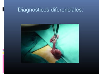Diagnósticos diferenciales:

 