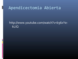 Apendicectomia Abierta
http://www.youtube.com/watch?v=b36xYekLIQ

 